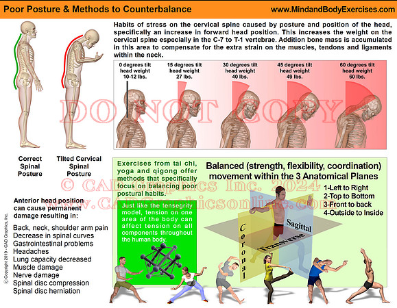 Poor Posture & methods to Counterbalancef