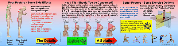 Poor Posture & methods to Counterbalance-slide show