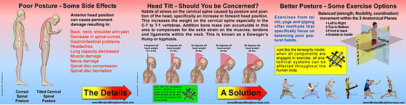 Poor Posture & methods to Counterbalance-slide show