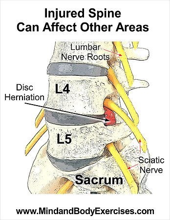 Injured Spine