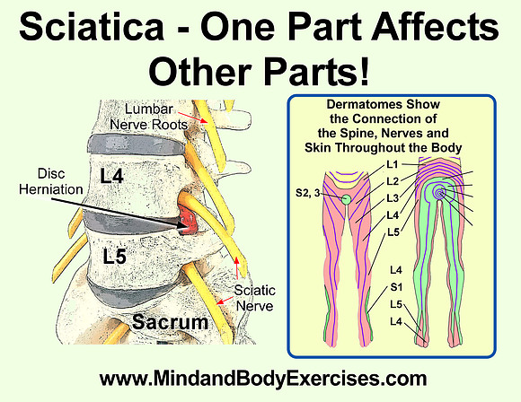 sciatica-one part affects other parts