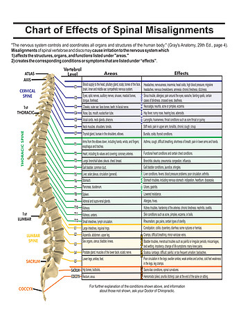 spine chart of effects of spinal misalignments