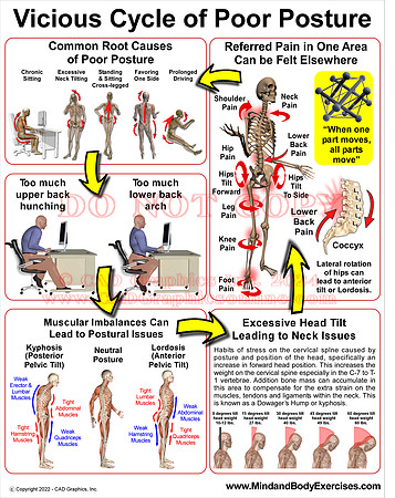 Vicious Cycle of Poor Posture