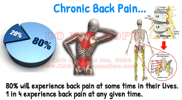 Back pain-image 1